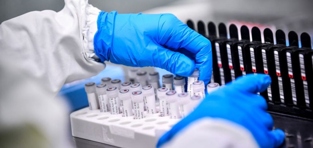 exame-laboratorio-coronavirus2-1900x900_c (1)