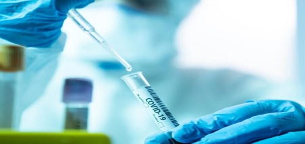 laboratorio-de-teste-covid-19-1591637192888_v2_450x337-1900x900_c