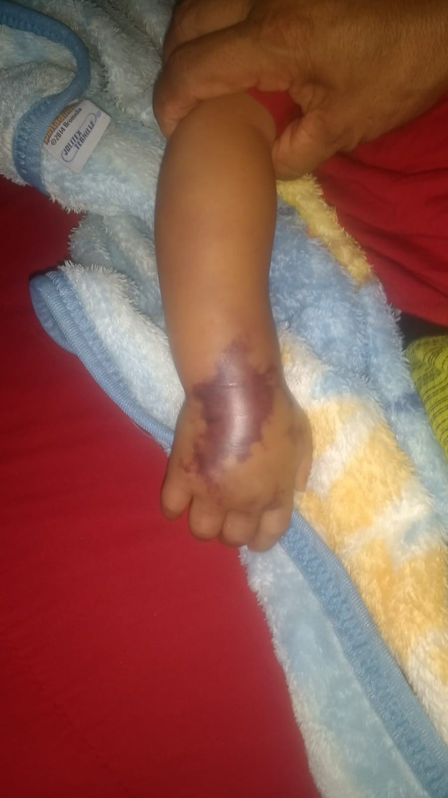 Bebê fica com veia do braço roxa e morre após internação em hospital no Piauí