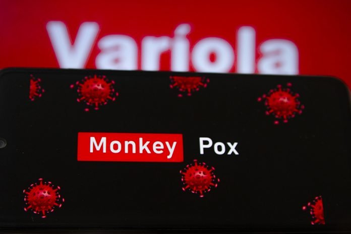 Varíola dos macacos chega a 67 municípios de São Paulo dois meses após 1º caso
