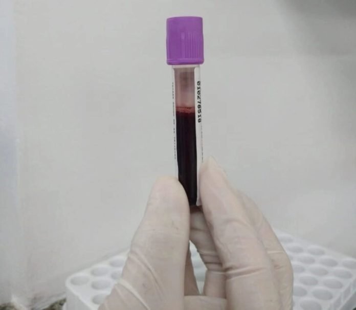 hemopi-realiza-cadastro-para-doadores-de-medula-ossea.jpg.800x0_q95_crop