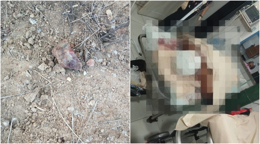 Homem agride ex em Paulistana e ingere soda cáustica ao notar chegada da PM - destaque